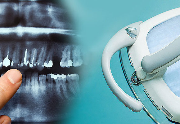 Dental Cleaning and Examinations